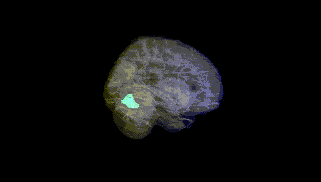 Full Brain Black