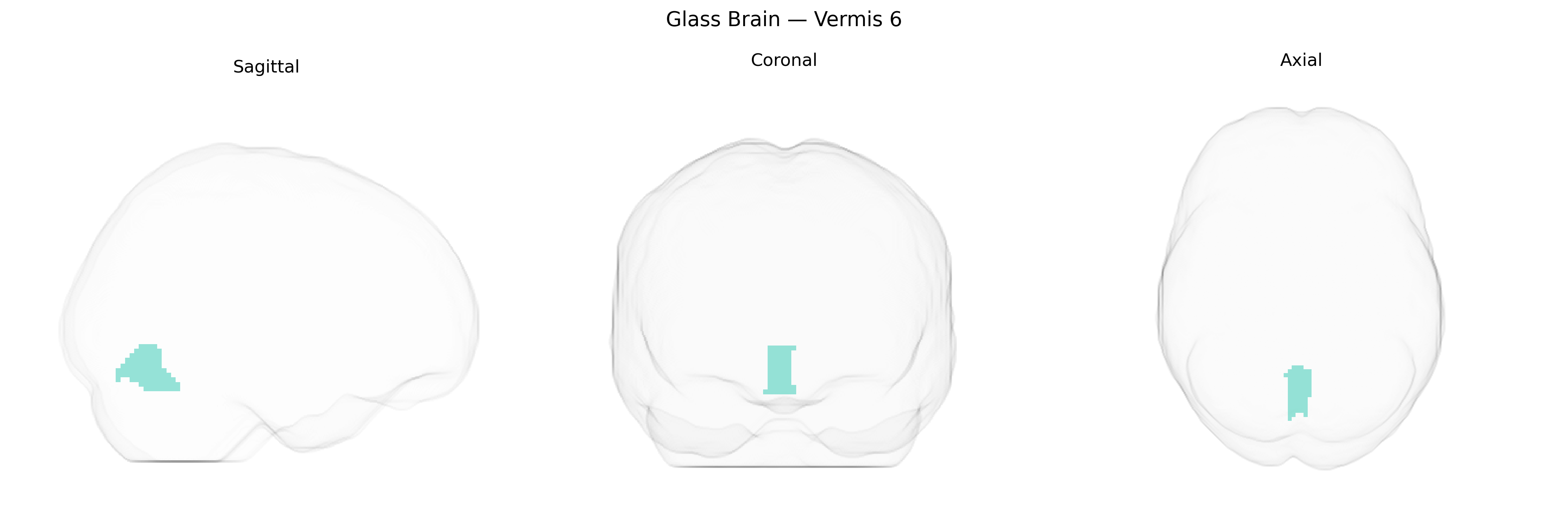 Triplanar Ghost Brain
