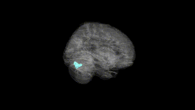 Full Brain Black