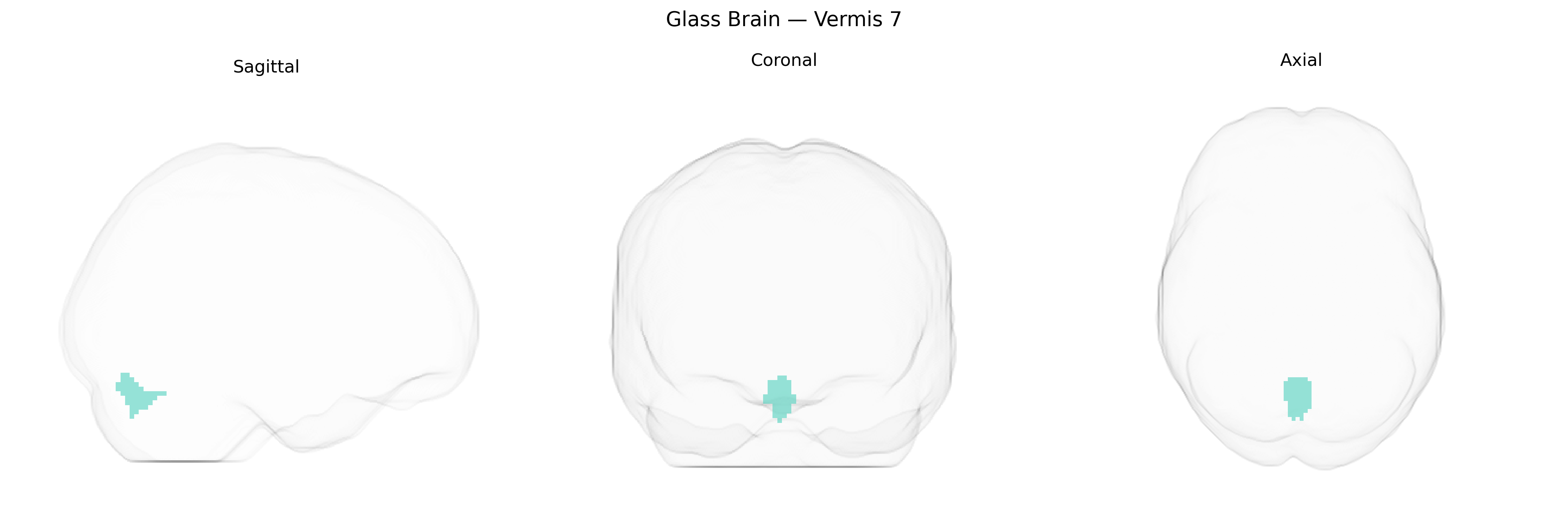 Triplanar Ghost Brain