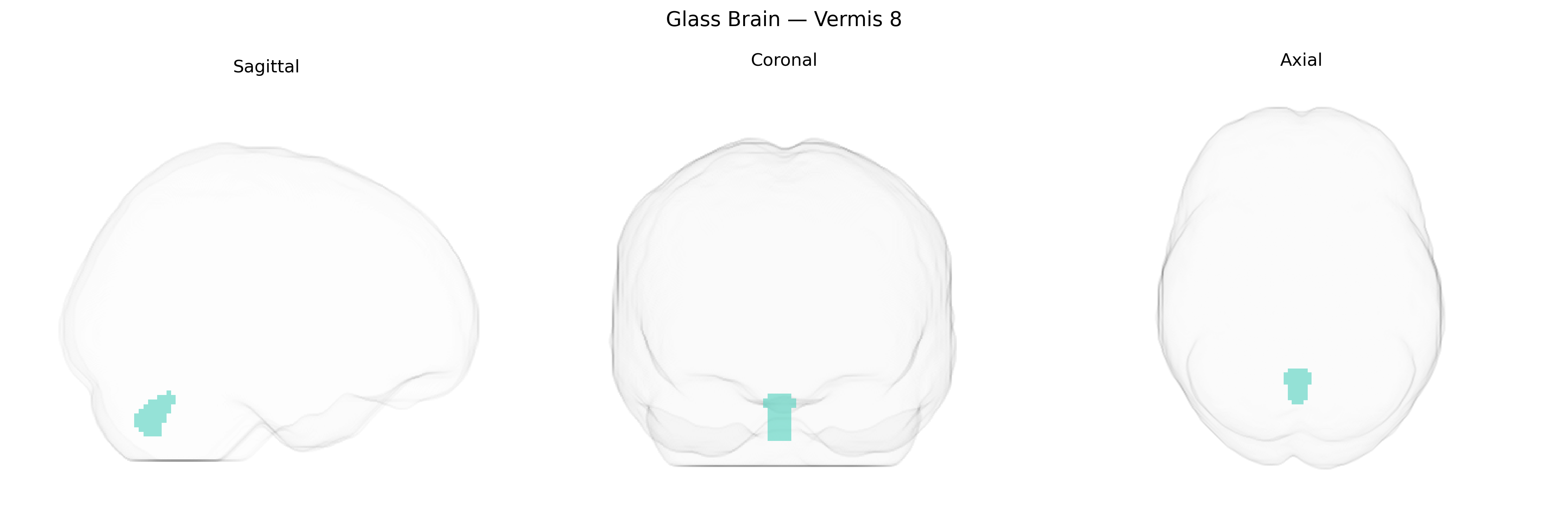 Triplanar Ghost Brain