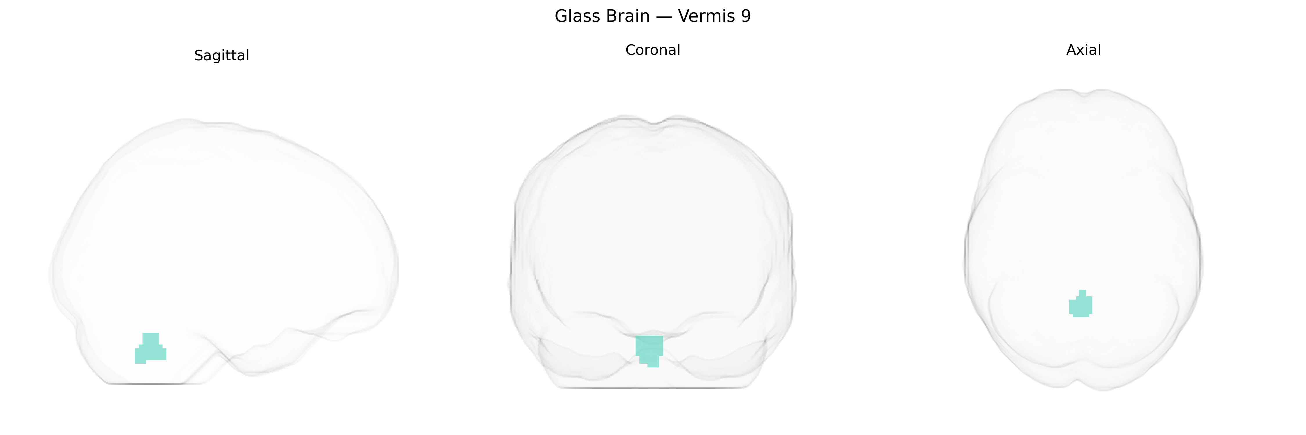 Triplanar Ghost Brain