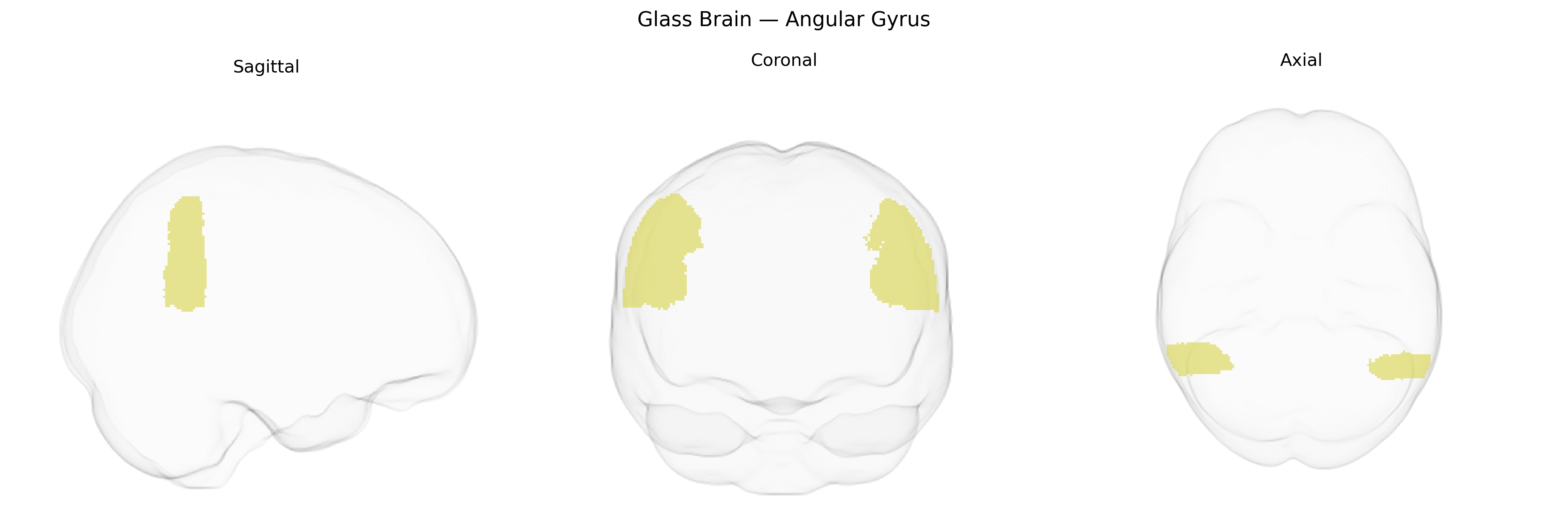 Triplanar Ghost Brain