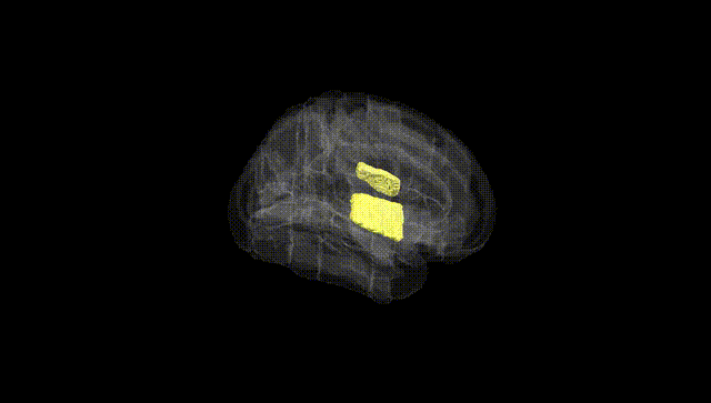 Full Brain Black