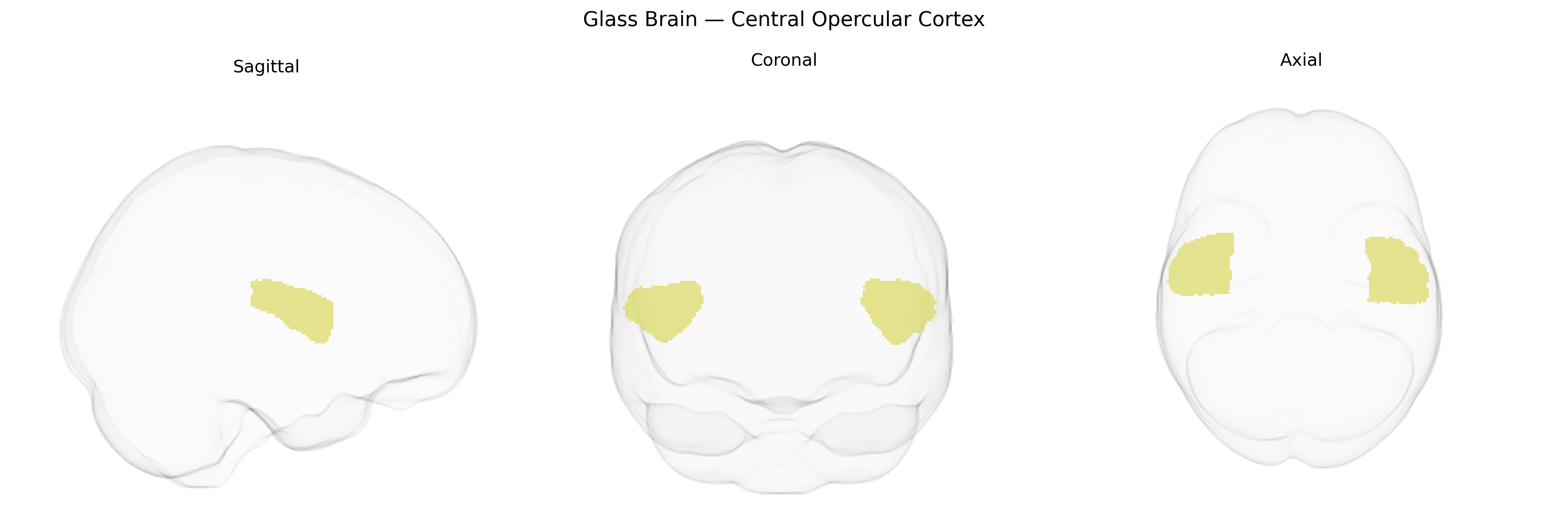Triplanar Ghost Brain