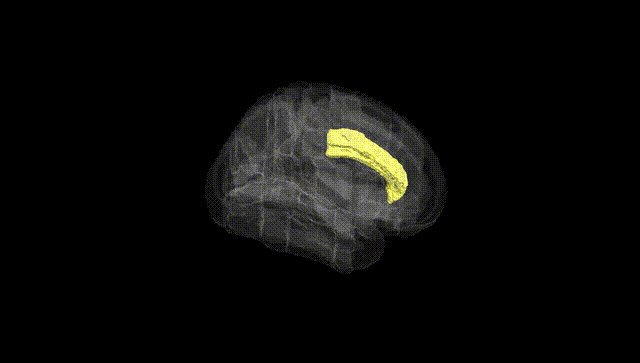 Full Brain Black