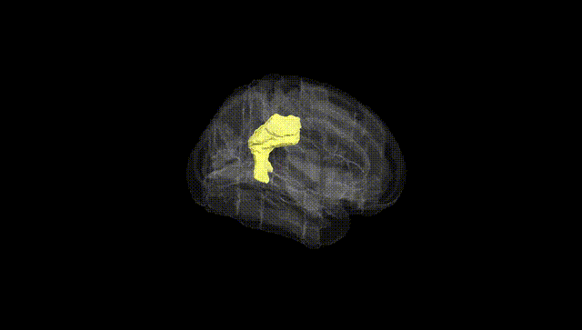 Full Brain Black