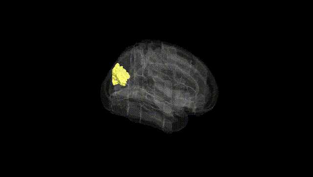 Full Brain Black