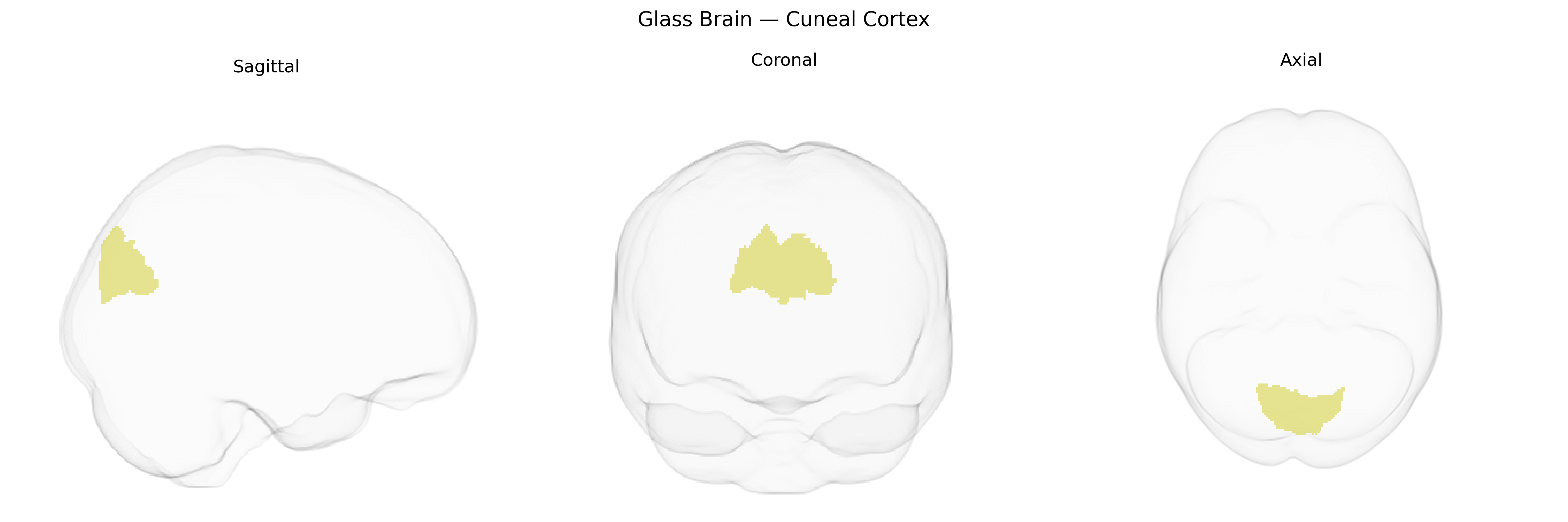 Triplanar Ghost Brain