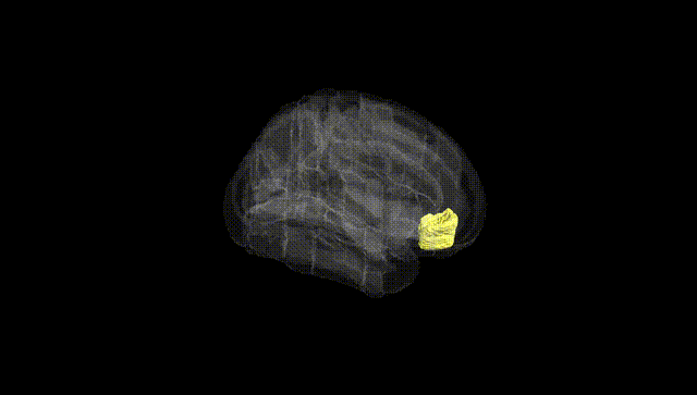 Full Brain Black