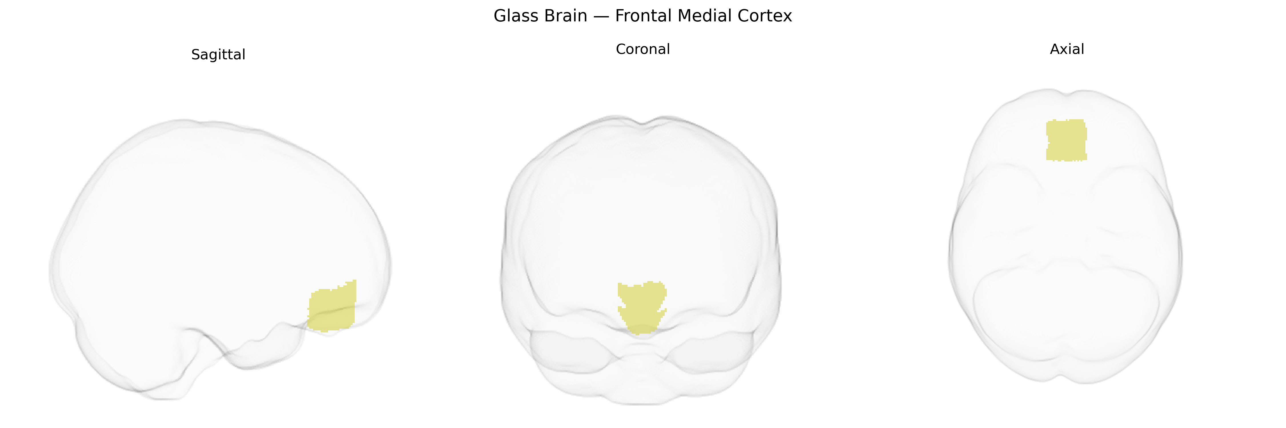 Triplanar Ghost Brain