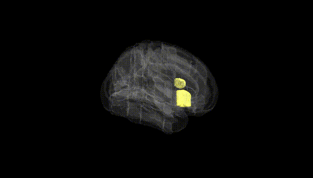 Full Brain Black