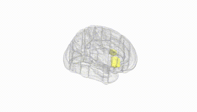 Full Brain White