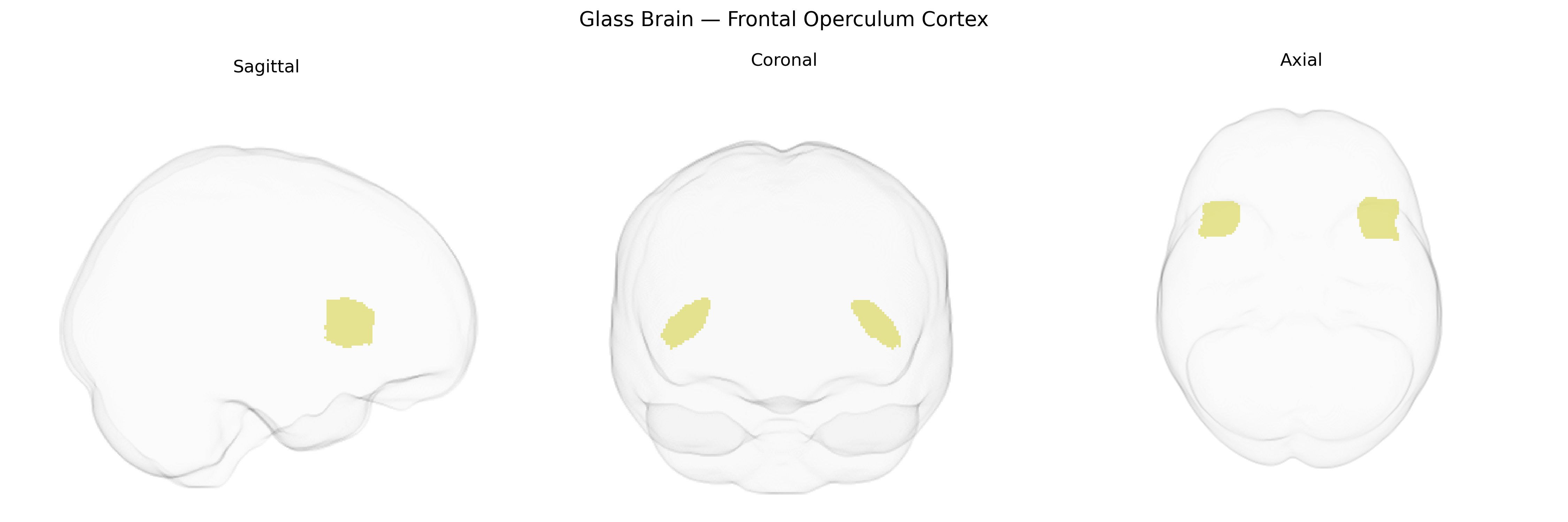Triplanar Ghost Brain