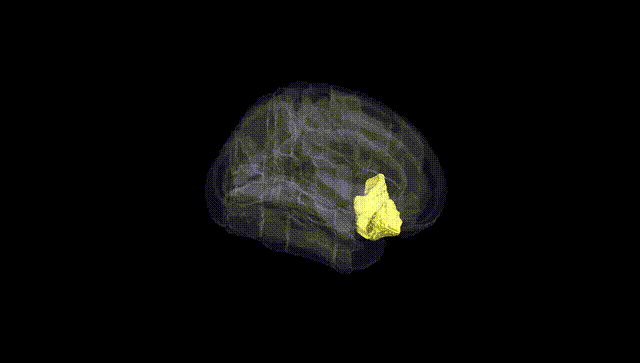 Full Brain Black
