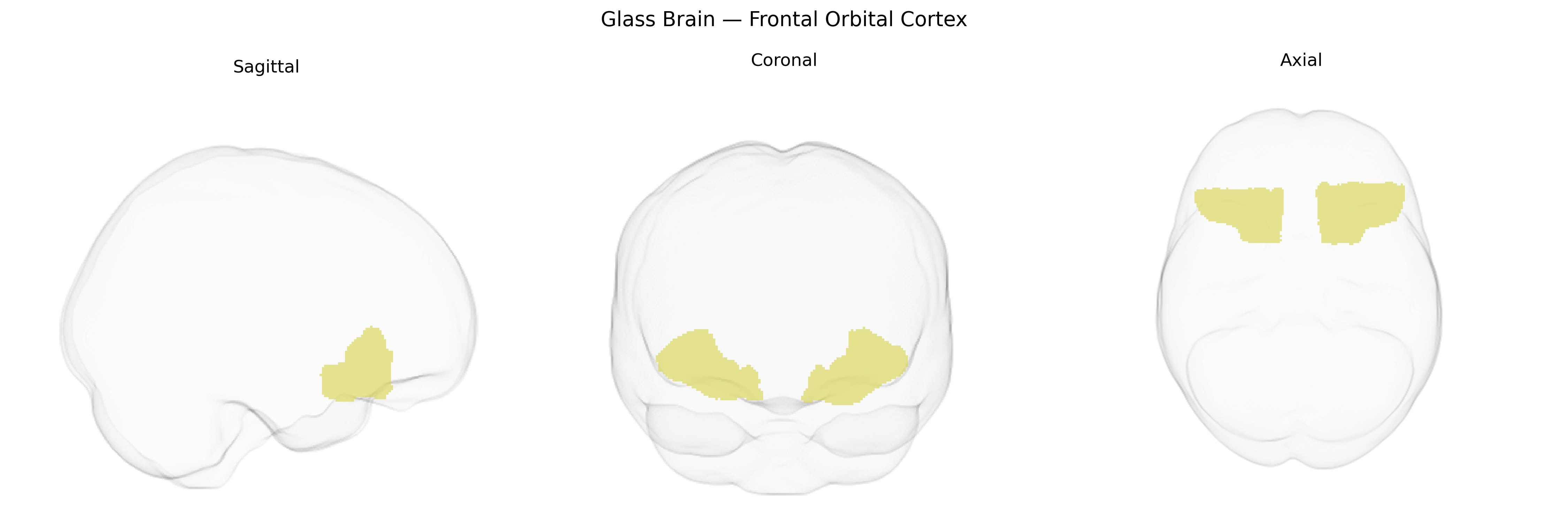 Triplanar Ghost Brain