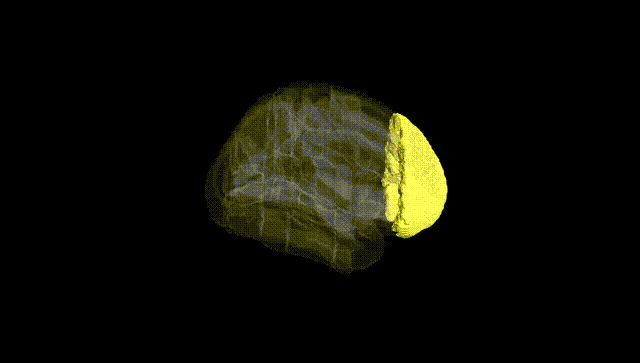 Full Brain Black