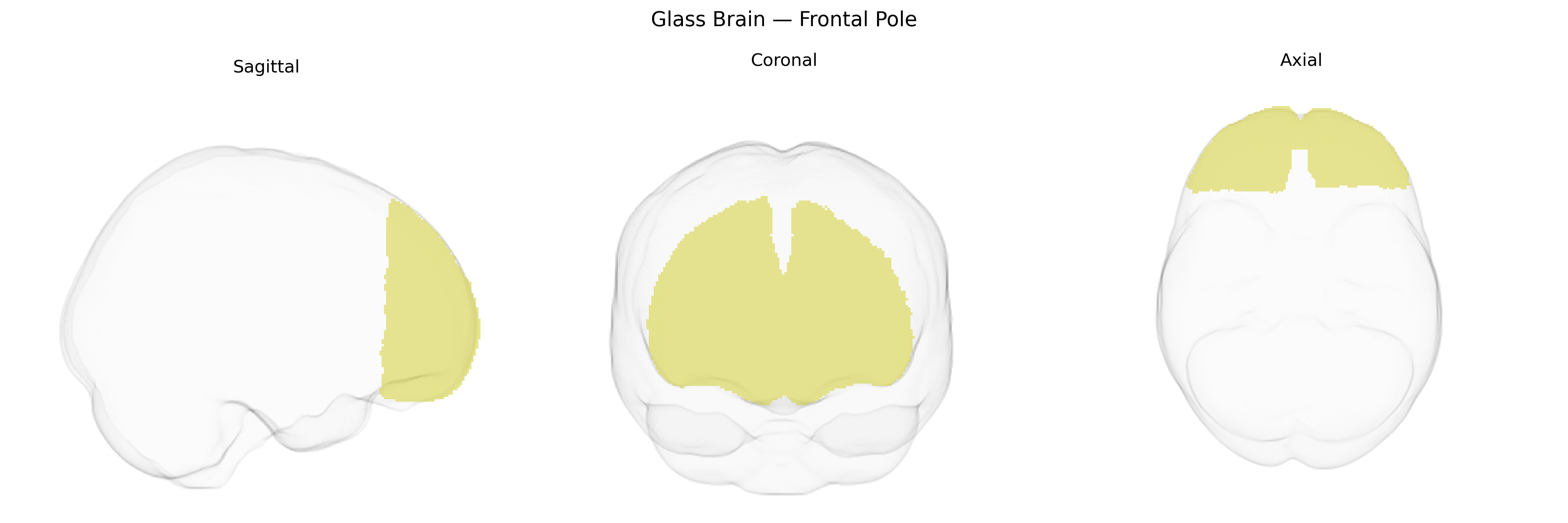 Triplanar Ghost Brain