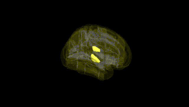 Full Brain Black