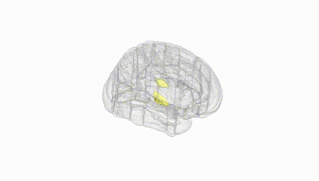 Full Brain White