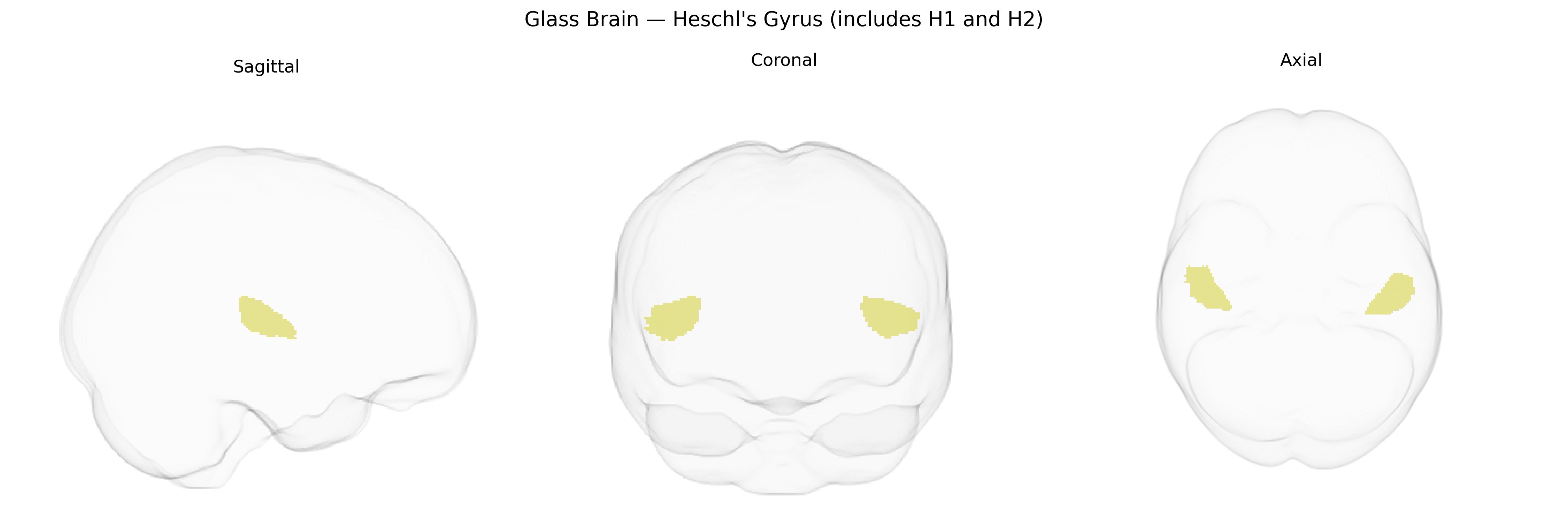 Triplanar Ghost Brain