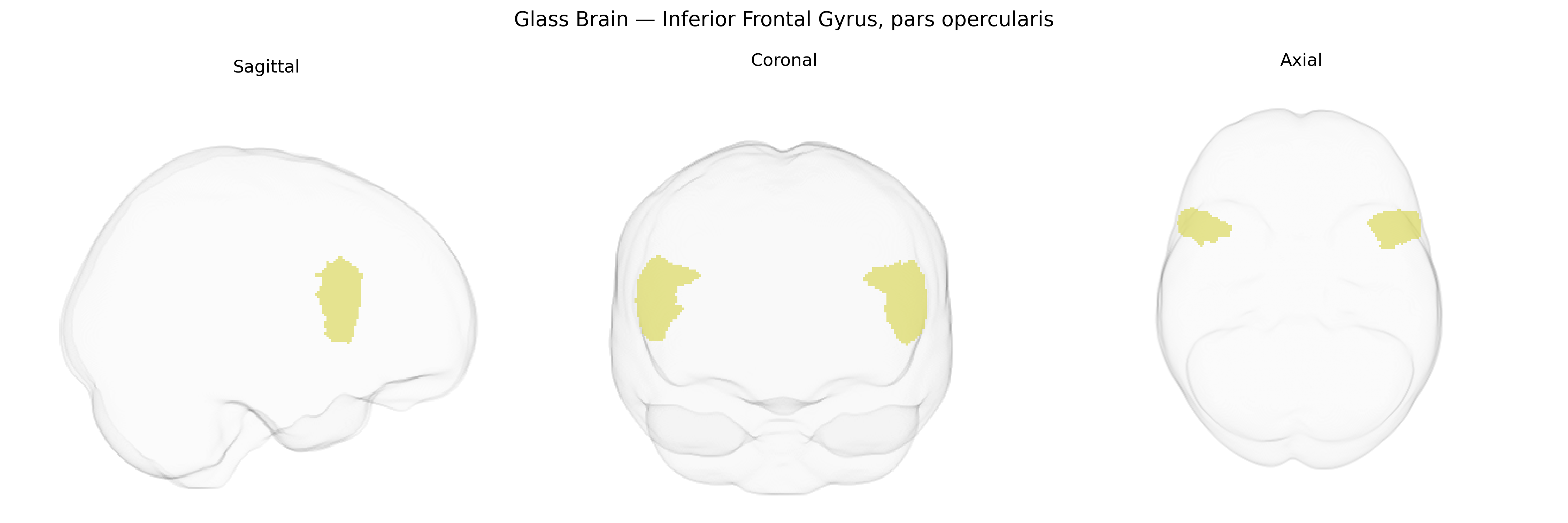 Triplanar Ghost Brain