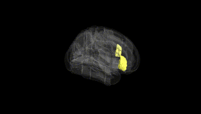 Full Brain Black