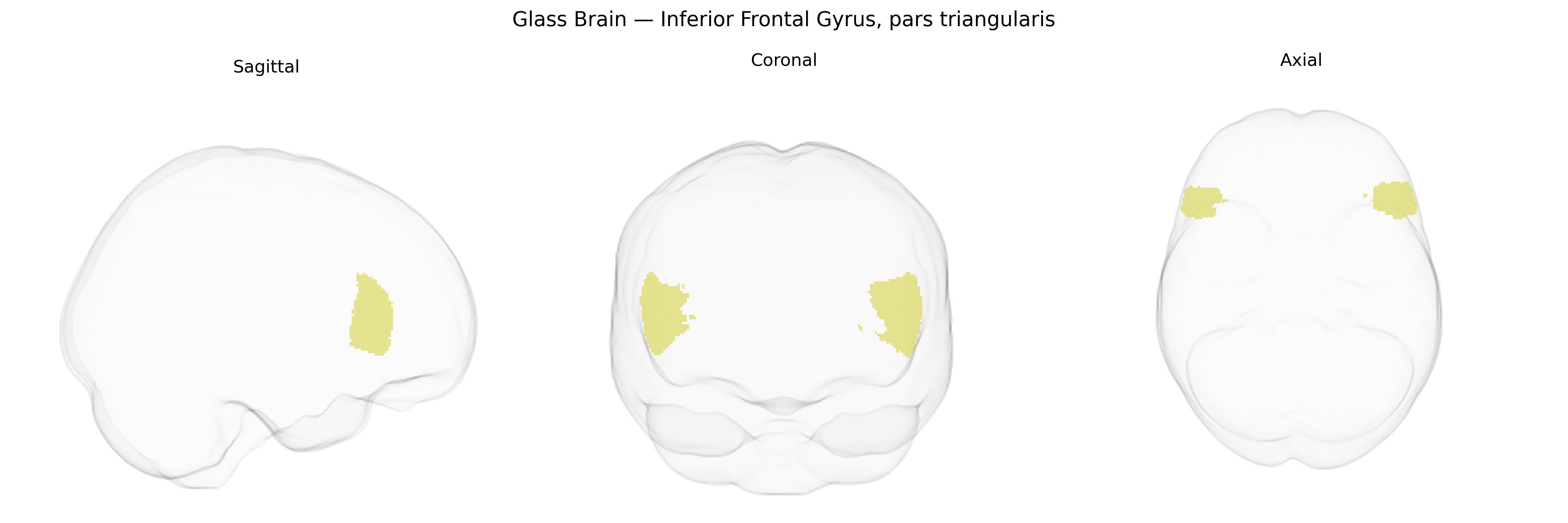 Triplanar Ghost Brain