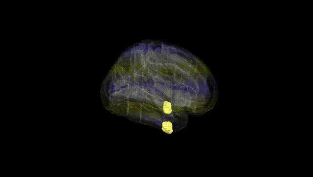 Full Brain Black