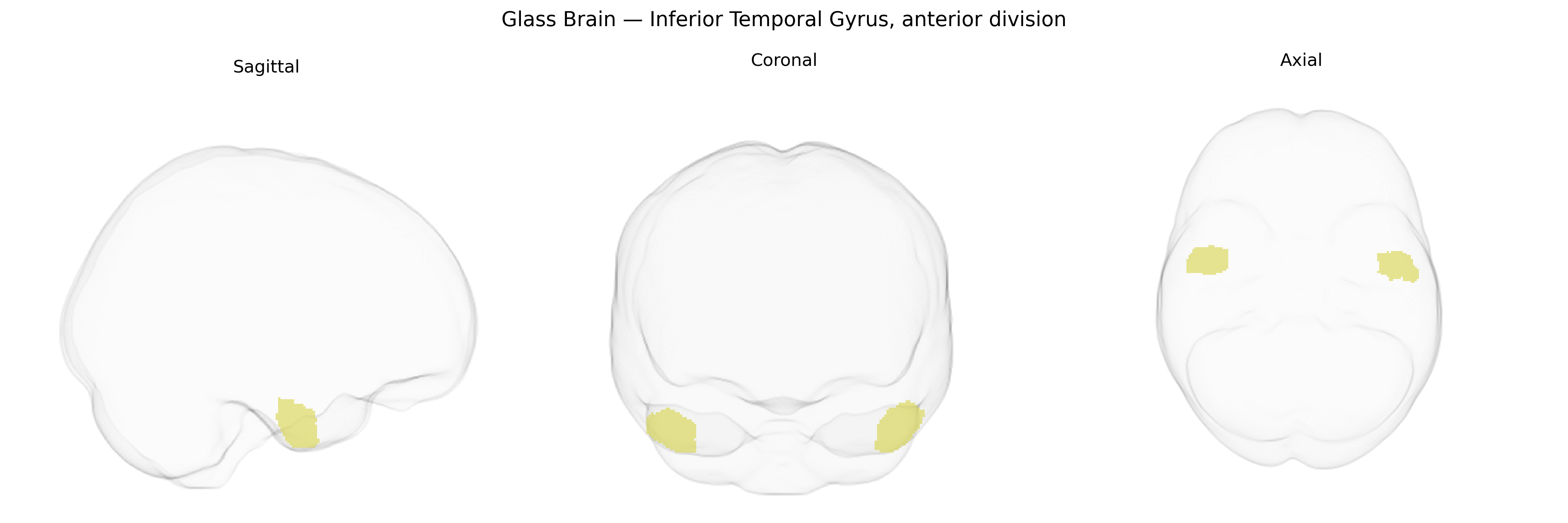 Triplanar Ghost Brain