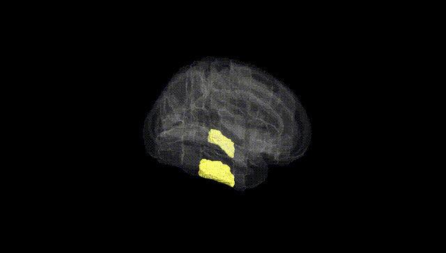 Full Brain Black
