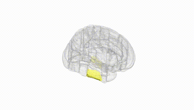Full Brain White