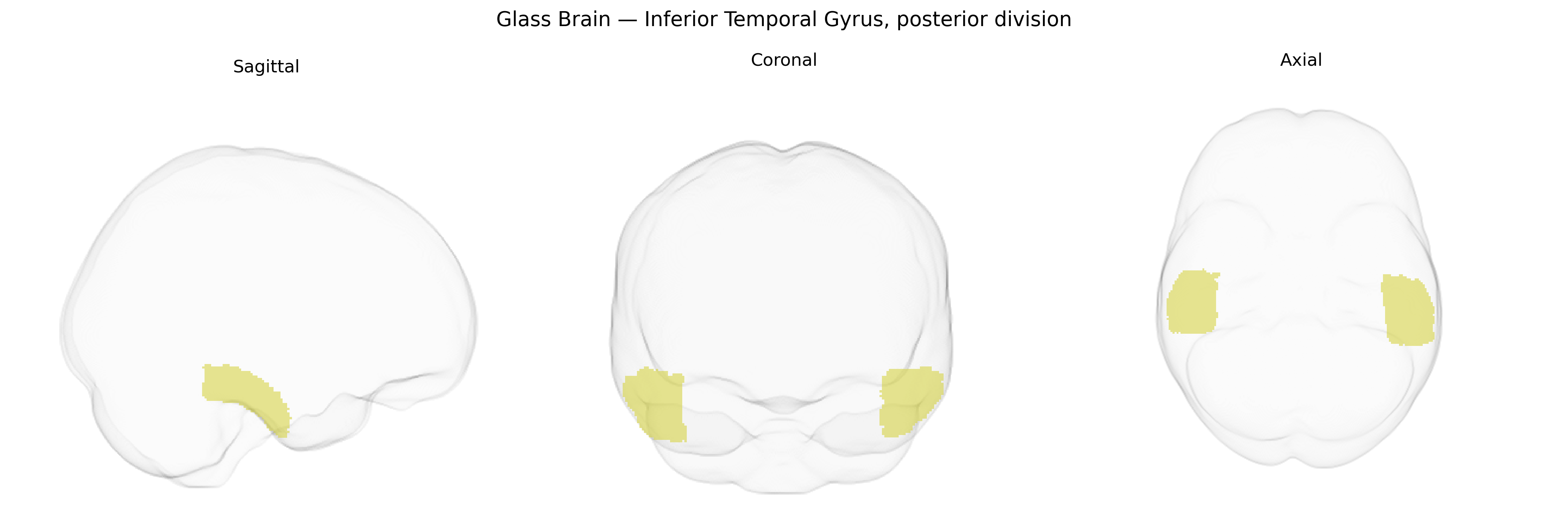 Triplanar Ghost Brain