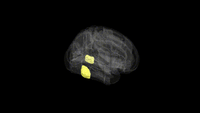 Full Brain Black