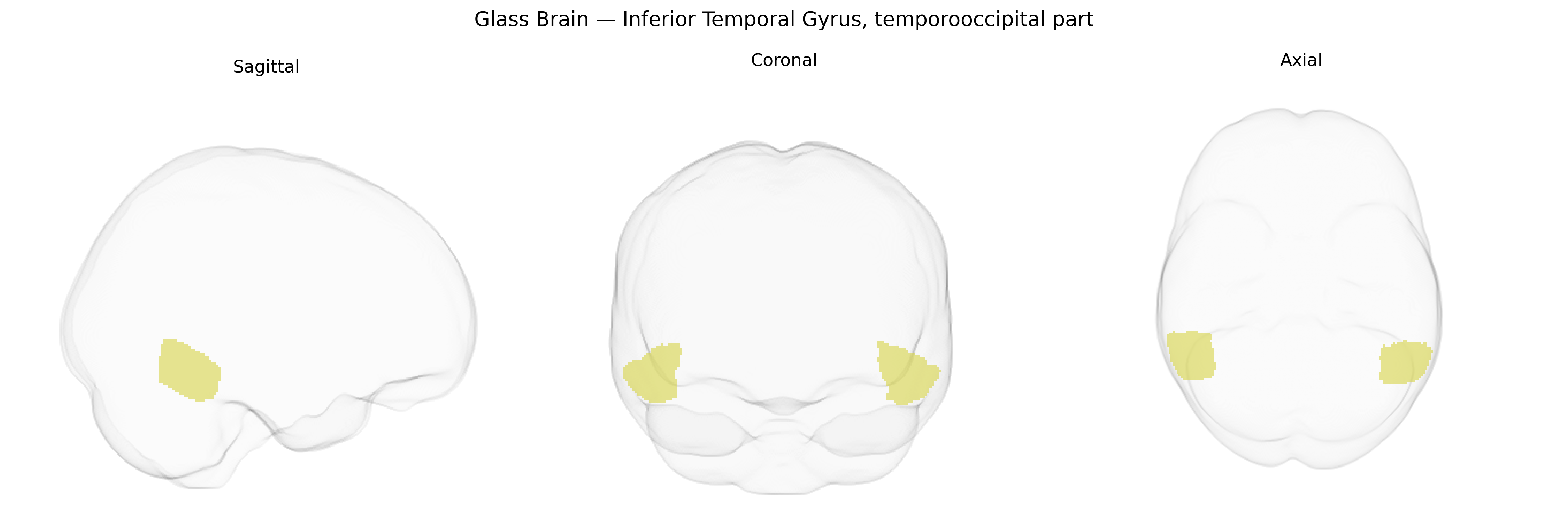 Triplanar Ghost Brain