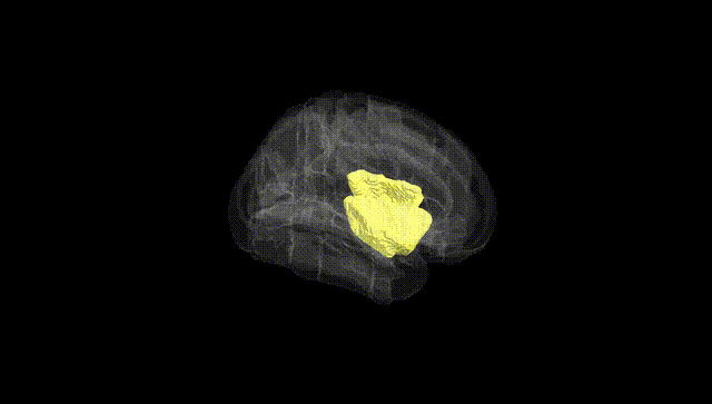 Full Brain Black