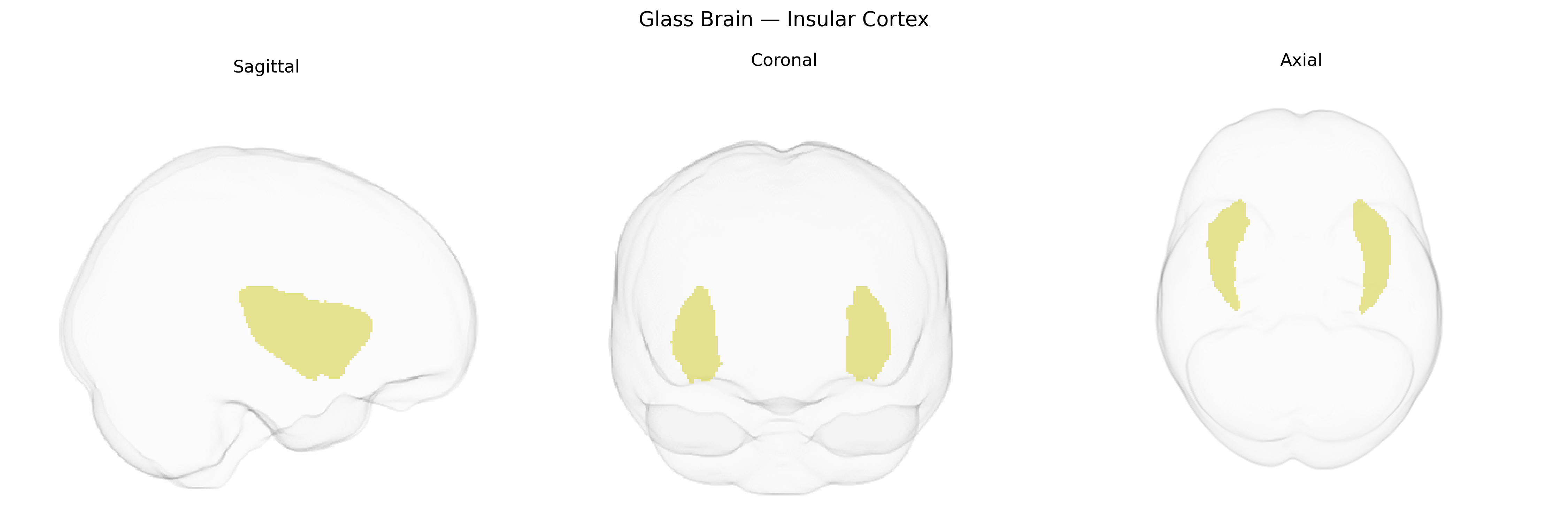 Triplanar Ghost Brain