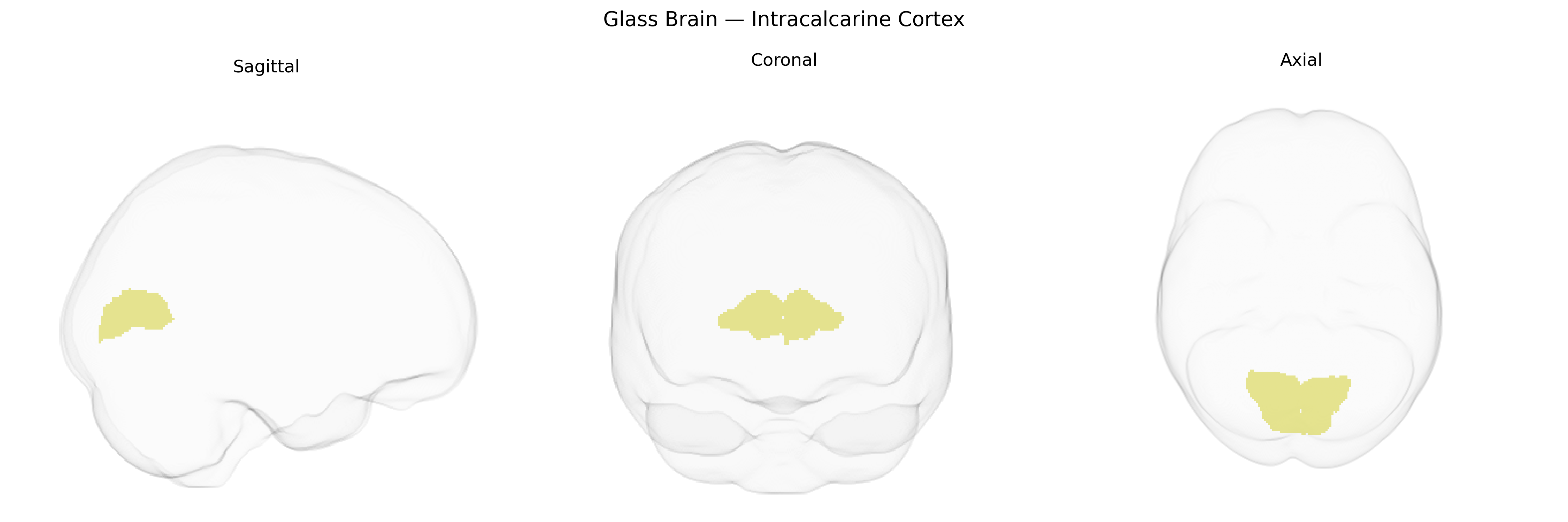 Triplanar Ghost Brain