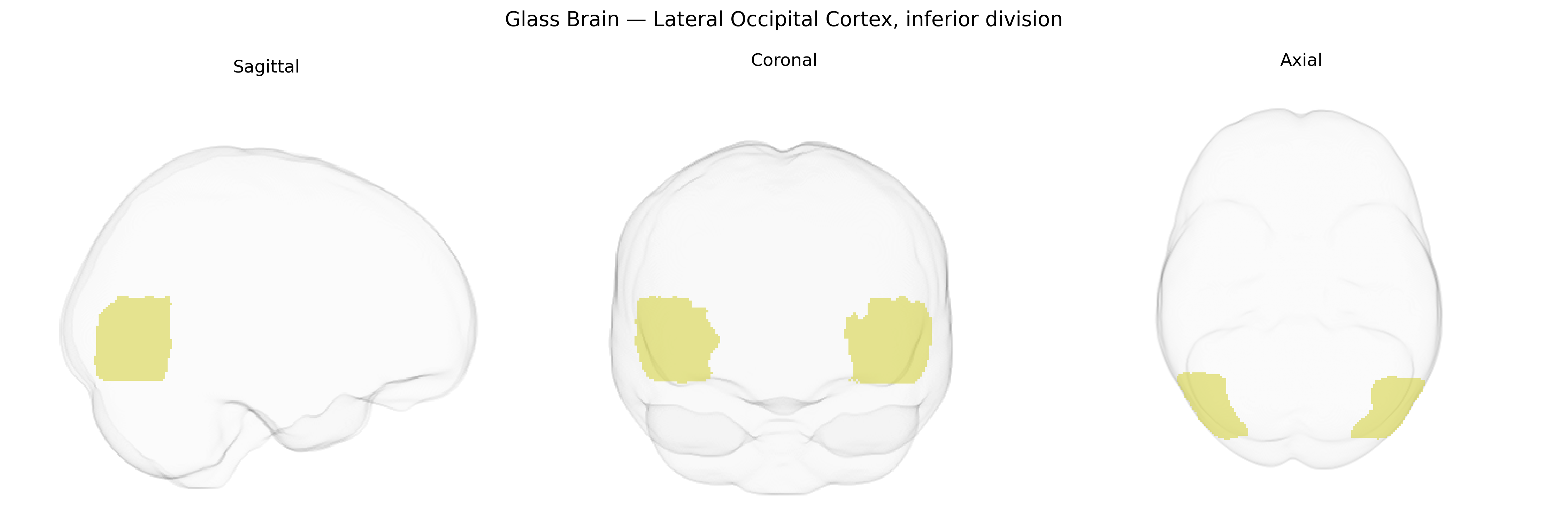 Triplanar Ghost Brain