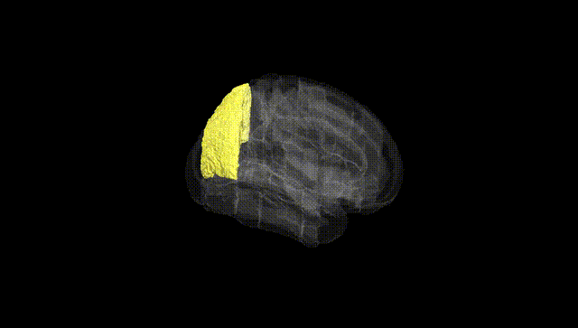 Full Brain Black