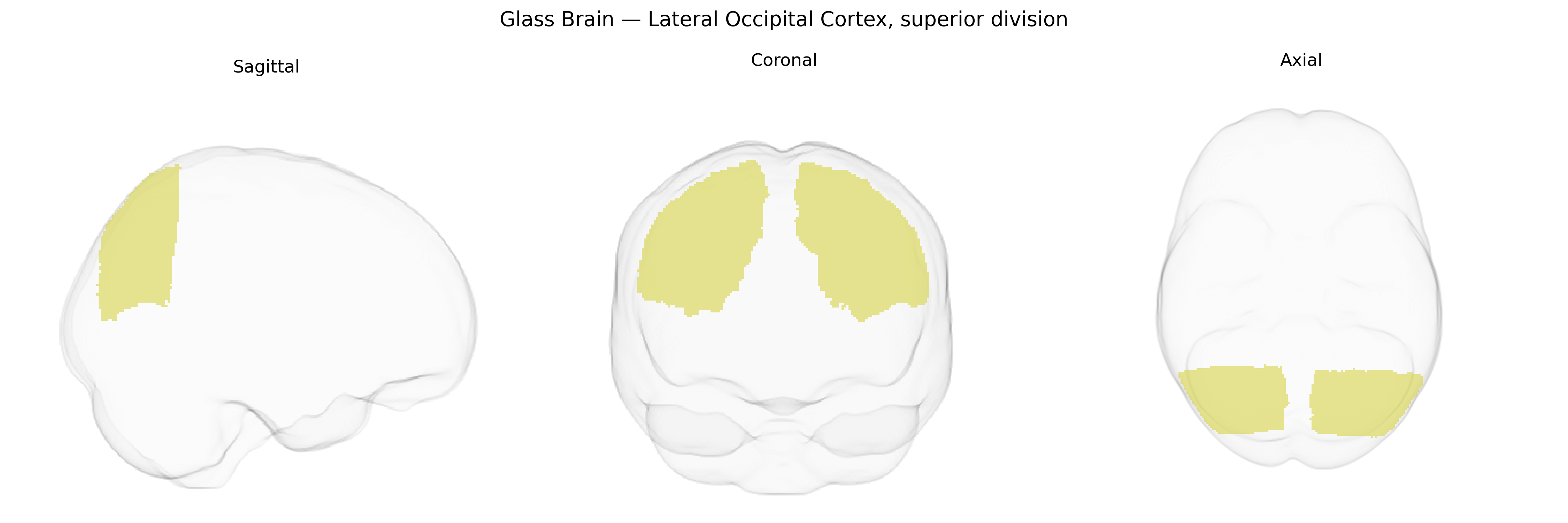 Triplanar Ghost Brain