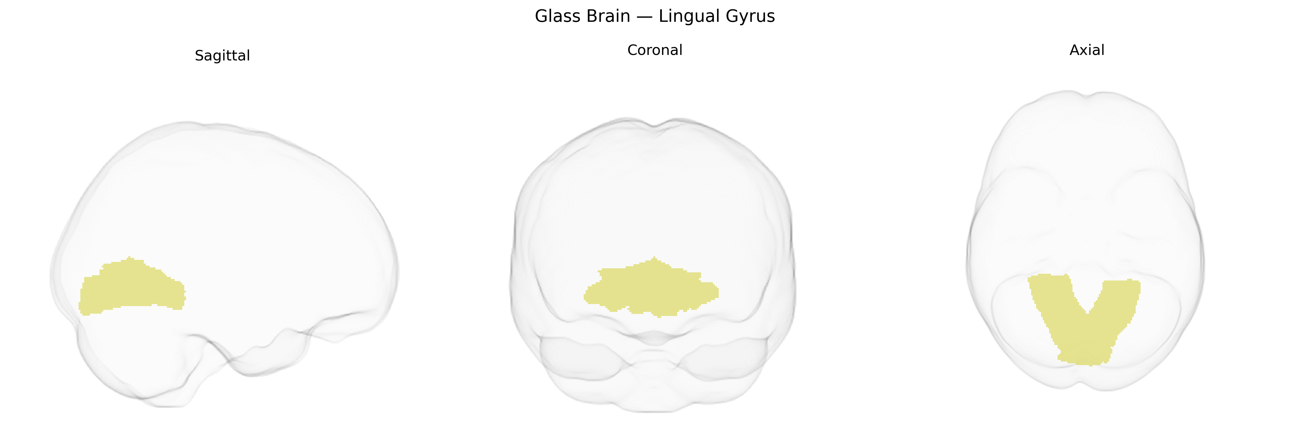 Triplanar Ghost Brain