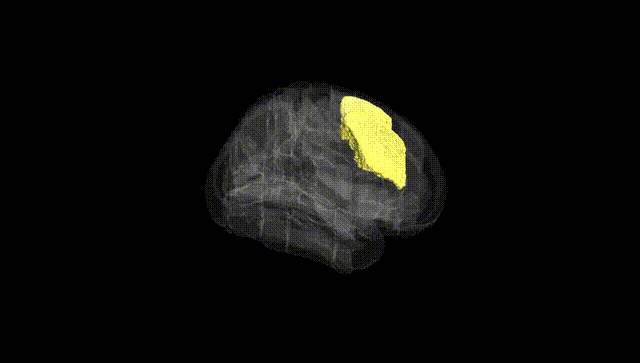 Full Brain Black