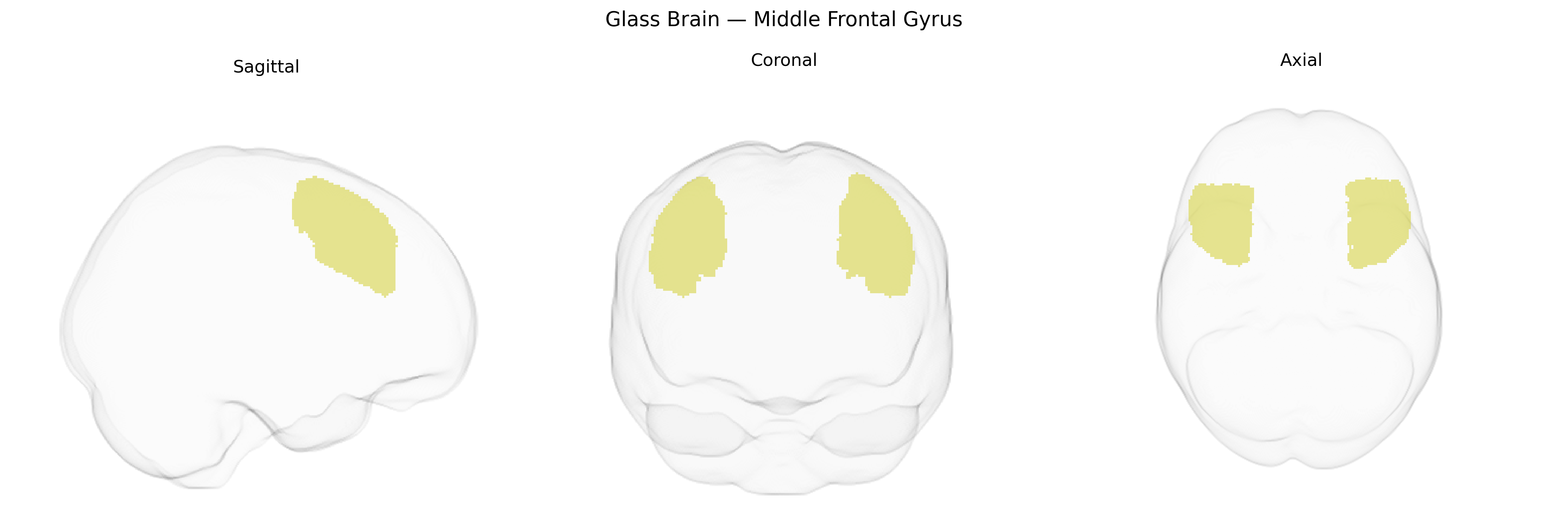 Triplanar Ghost Brain