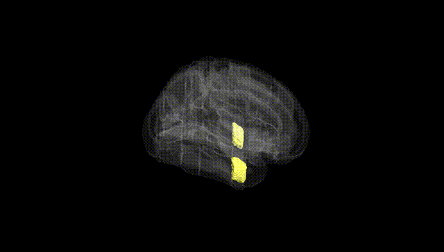 Full Brain Black