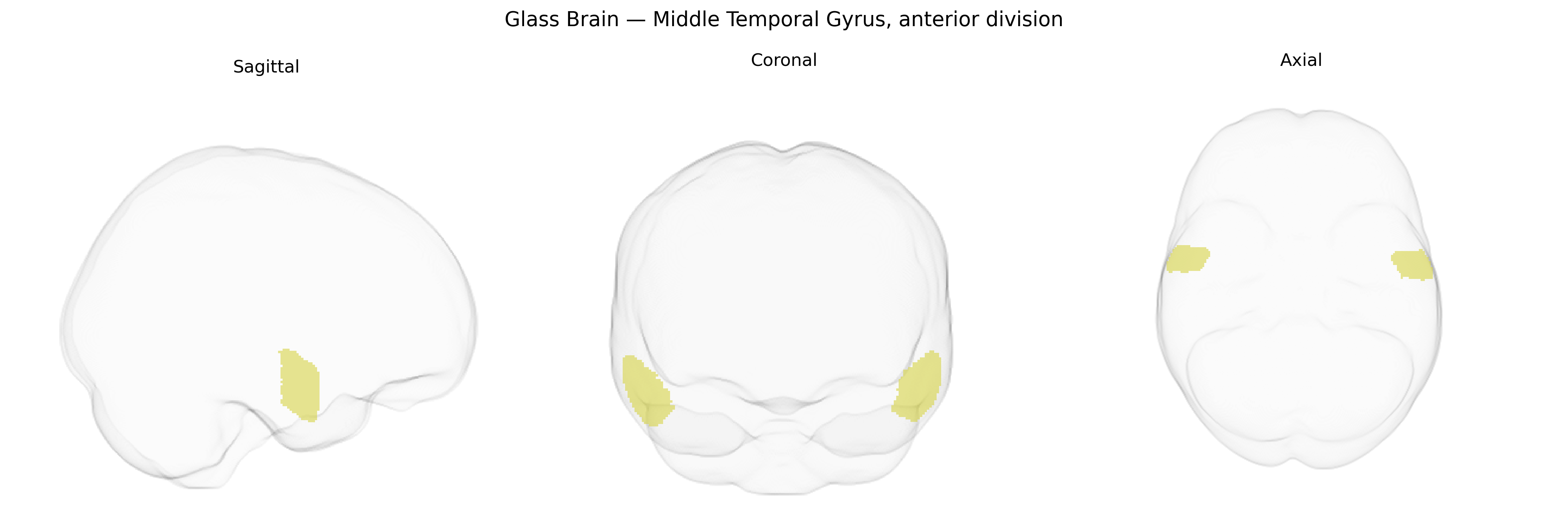 Triplanar Ghost Brain