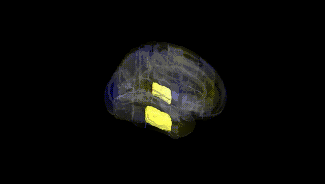 Full Brain Black