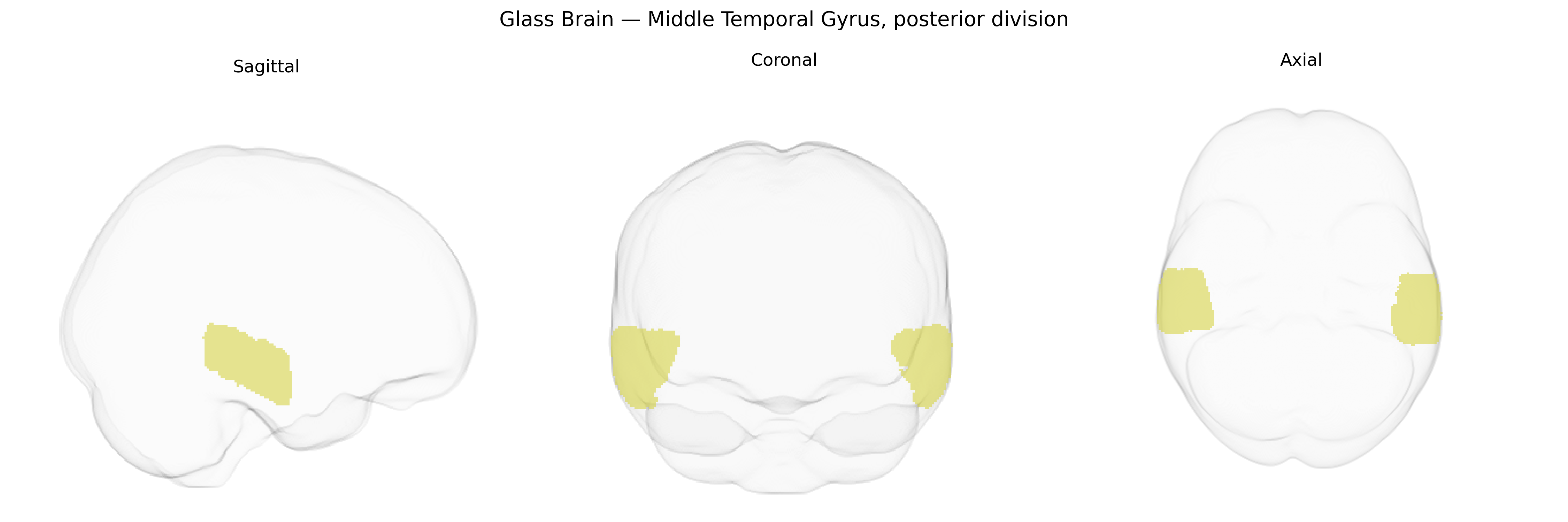 Triplanar Ghost Brain