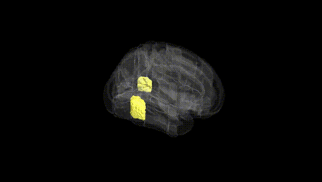 Full Brain Black