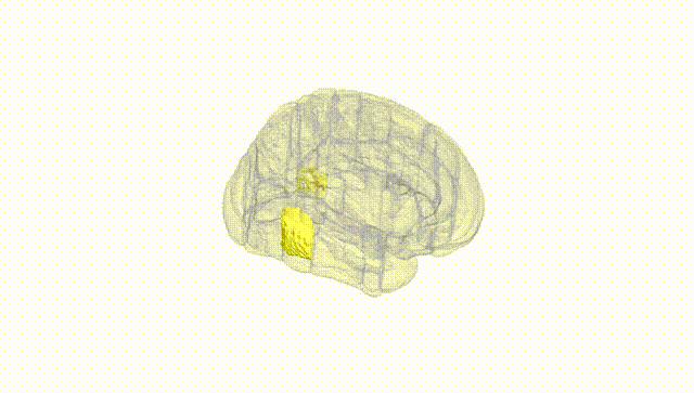 Full Brain White